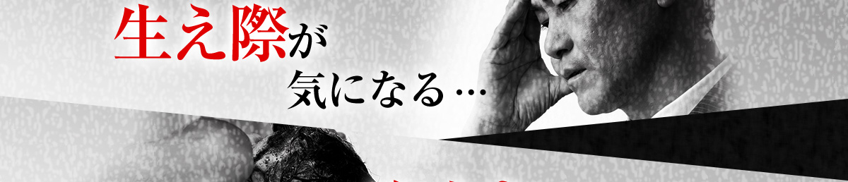 生え際が気になる…